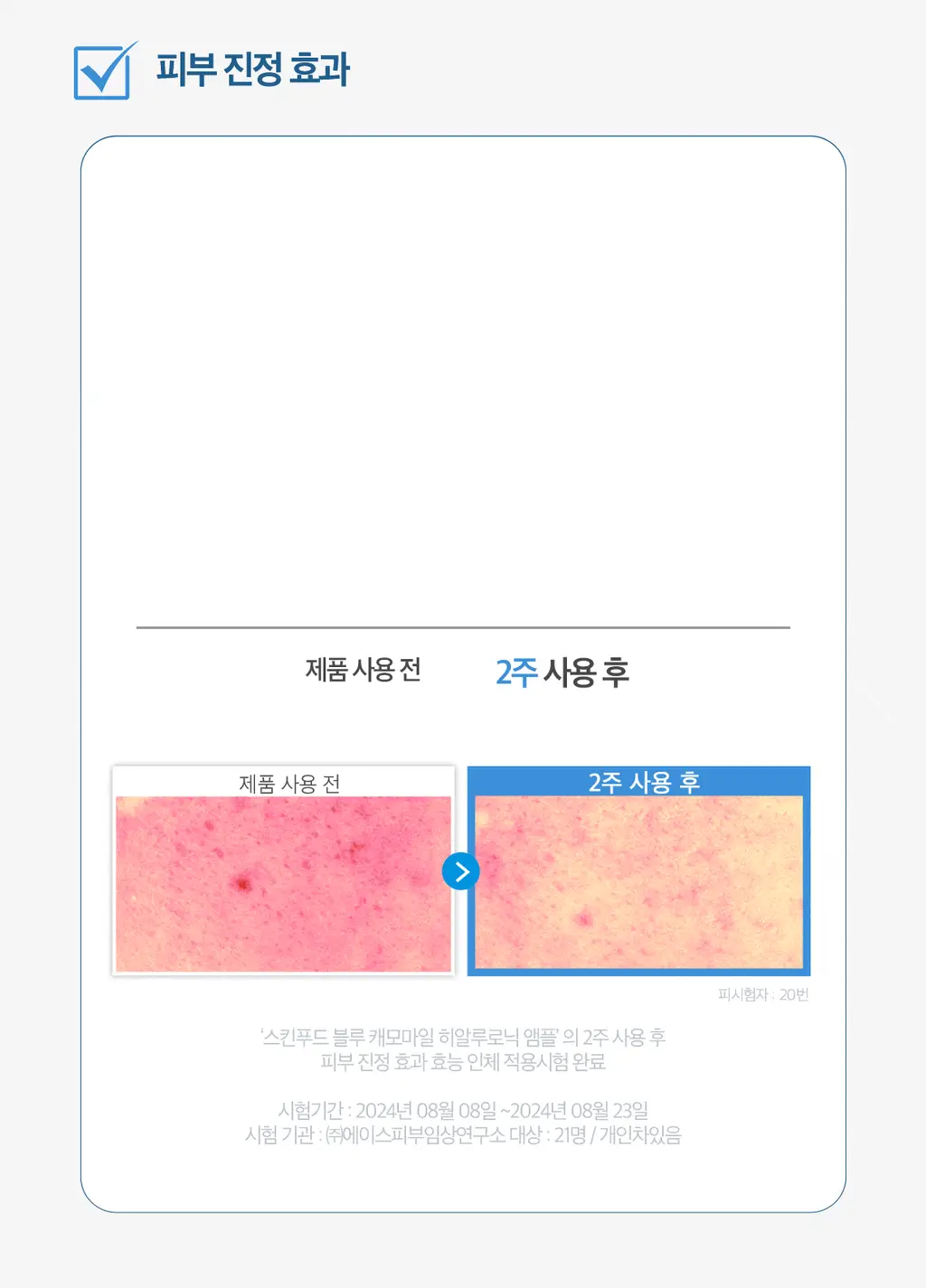 [쫀득물착앰플] 스킨푸드 블루 캐모마일 히알루로닉 앰플 50ml 상세페이지 10